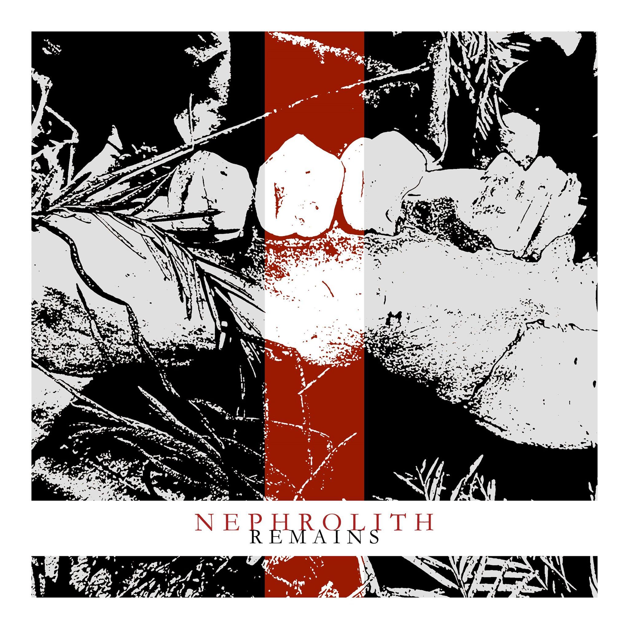 Nephrolith napovedujejo EP Remains