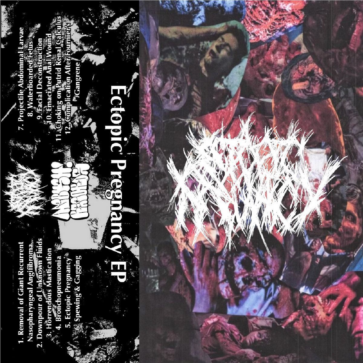 Izšel je nov EP dvojca Ectopic Pregnancy